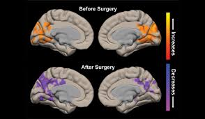 Image result for Temporal Lobe