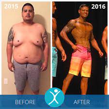 Commitment to making these changes is often required before a surgeon will perform the. Gastric Sleeve Before And After Photos The Best Pictures Of 2020
