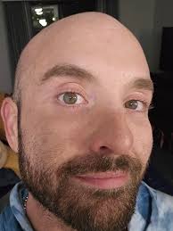 What's the unusual pattern