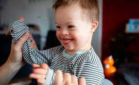 First off, they look pretty normal to me. Windelmarke Zeigt Zum 1 Mal Babys Mit Down Syndrom In Ihrer Werbung