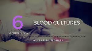 Flowers for all occasions blood cultures lyrics. Blood Cultures The Way It Was Meant To Be Lyrics L Hit Com Lyrics