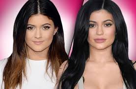 We talk to a woman who had a nose job to find out what it's really like to get plastic surgery. Fill Er Up Kylie Jenner S New Face Came From A Needle Docs Claim