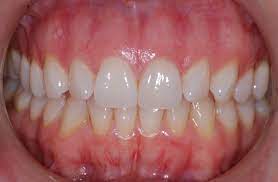 Cyndi is a passionate writer who writes about lifestyle tips on lifehack. Periodontal Specialist Gum Disease Specialist Cotswold Periodontal Centre Check Your Gums