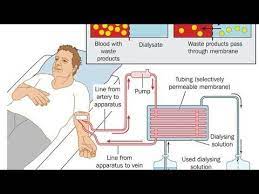 Renal Failure Dialysis And Kidney Transplant Homeostasis 2nd Year Biology Punjab Text Book Youtube Kidney Transplant Cell Transport Biology Online