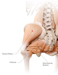 Image result for Snapping Hip