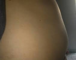 Tamanho Da Barriga Com 8 Semanas Minha Primeira Gravidez Babycenter