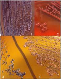 Comparison of tm with tcpm for. Modification Of The Congo Red Agar Method To Detect Biofilm Production By Staphylococcus Epidermidis Sciencedirect