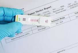 Alpha Fetoprotein Afp Blood Test During Pregnancy