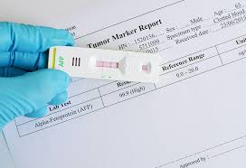 alpha fetoprotein afp blood test during pregnancy