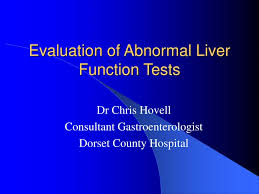 Image result for Liver Function Test Abnormality