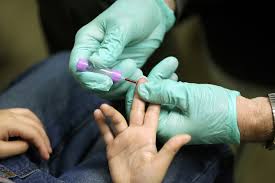 Heel stick is the only acceptable manner of collection for laboratory personnel in this age group unless infant weight is 21 pounds or greater than an arm draw can be performed. Testing Children For Lead Exposure Explained Shots Health News Npr