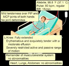 Image result for Septic Joint