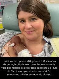 Nash Keen: o bebê mais prematuro do mundo completa um ano e emociona com  história de superação Nascido com apenas 280 gramas e 21 semanas de  gestação, Nash Keen celebrou no último