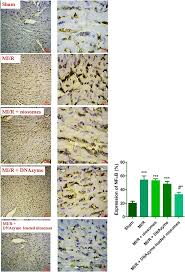 Effects of nano-niosomes containing DNAzyme on NF-kB p65 expression. (***p  | Download Scientific Diagram