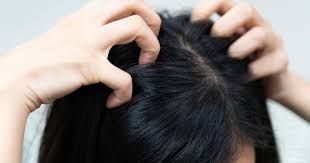 5 أسباب لحكة فروة الرأس وعلاجها سوبر ماما