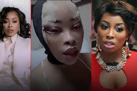 I feel like a normal person' - Khanyi Mbau speaks on latest plastic surgery  - Swisher Post