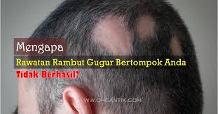 Kalau sapu / vacuum rumah, banyaknya rambut carian berkaitan: Atasi Rambut Gugur Ohcantik Com