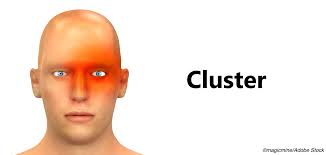 Prednisone Reduces Cluster Headache Attacks During Verapamil Titration