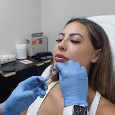 TOP 10 BEST Fillers and Botox in San Diego, CA