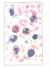 2021 kcpe kcse knec timetable. Kcse Past Papers 2018 Biology Paper 3 Knec Kcse Online