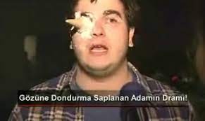 Dikkat Sahan Cikabilir Dikkat Sahan Cikabilir Sinematurk Com
