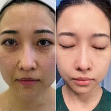 7 cơ sở spa trị thâm quận Tân Phú uy tín, có “tâm và tầm”