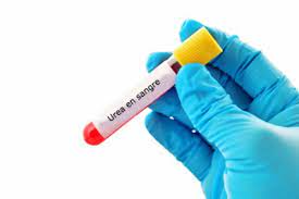 La urea alta en sangre es una situación que puede aparecer por diversas causas, siendo la principal la existencia de algún problema en los riñones. Urea Baja En Sangre Causas Sintomas Y Tratamiento