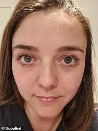 Nurse asked daily if she is the famous Game of Thrones actress who plays  Arya Stark