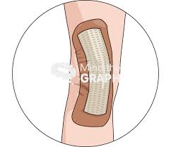 Image result for Occlusive Dressing