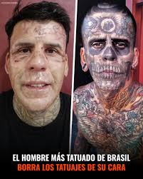 Leandro de Souza, una vez el hombre más tatuado de Brasil con el 95 % de su  cuerpo entintado, ahora está borrando esos tatuajes, comenzando por su  cara. Después de encontrar la