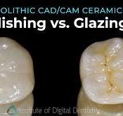 Polishing VS Glazing Dental Ceramics | Digital Dentistry ...