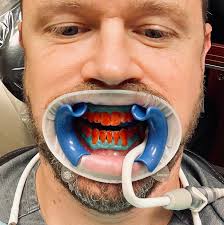 Modern Dental Care