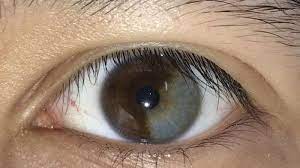 7 fakta unik soal rambut di tubuh manusia, anak bayi pun punya. 14 Manusia Langka Yang Punya Anggota Tubuh Unik Ada Yang Sepertiga Bola Matanya Berwarna Abu Abu Tribunnews Com Mobile