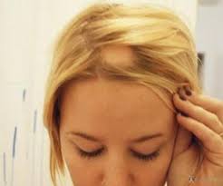 Genel olarak sirke ile gargara yapmak ya da el dezenfektanı i̇çerisinde herhangi bir kimyasal bulunmayan elma sirkesi ya da beyaz sirke dezenfekte eder mi merak ediyorsanız bu karışımların etkisini. Beyaz Sirke Nedir Beyaz Sirkenin Faydalari Nelerdir