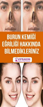 Burun Kemigi Egriligi Bursa Saglik Bakim Saglikli Yasam