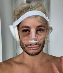 New nose. Who dis? 👃❤️‍🩹