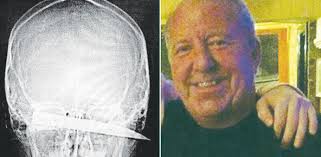 Patient who stopped medication stabbed man more than 200 times