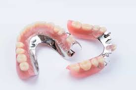 How much do dentures cost. Types And Cost Of Partial Dentures District Dentistry Charlotte