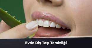 Diş taşı (tooth stone), diş eti çizgisinin altında ve üstünde biriken bakteri plağının sertleşmiş halidir. Evde Dis Tasi Temizligi Dogal Dis Tasi Temizleme Yontemleri