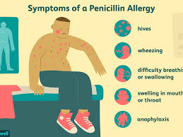 Children And Penicillin Allergic Reactions