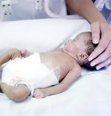Pour la définir, selon une recommandation de l organisation mondiale de la santé (oms) grande prématurité (de 27 à 32 sa) Bebes Prematures Des Meres Temoignent Marie Claire