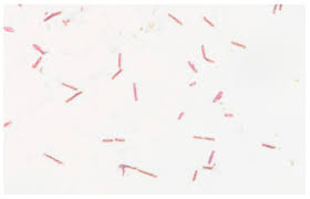 Image result for Rhizobium radiobacter, syn. Agrobacterium tumefaciens