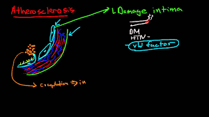 Pathophysiology Of Atherosclerosis