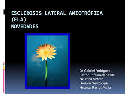 La esclerosis lateral amiotrófica (ela) es la enfermedad de la neurona motora (enm) más común. Ppt Esclerosis Lateral Amiotrofica Ela Novedades Powerpoint Presentation Id 4895293