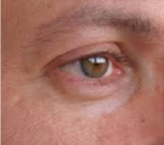 Uzm Dr Hakan Buzoglu Dermatoloji Uzmani