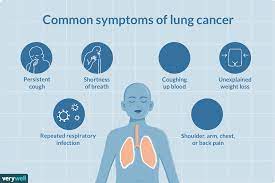 This sign can be deceptive as smokers frequently have a cough already. Lung Cancer Signs Symptoms And Complications