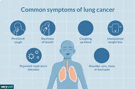 Not every symptom that could be cancer is cancer. Lung Cancer In Young Adults