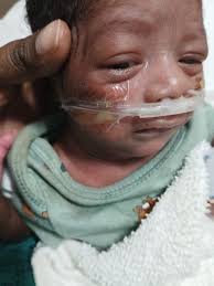 Medical Tyranny and CPS Retaliation: How a Texas Hospital and DFPS Stole  Our Infant Without a Court Order