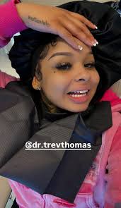 Million dollar smile 😃 #chrisean matianubolo @dr.trevthomas Edr.