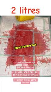 Image result for Blood Volume